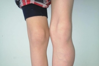 Dumitrescu Razvan Denis